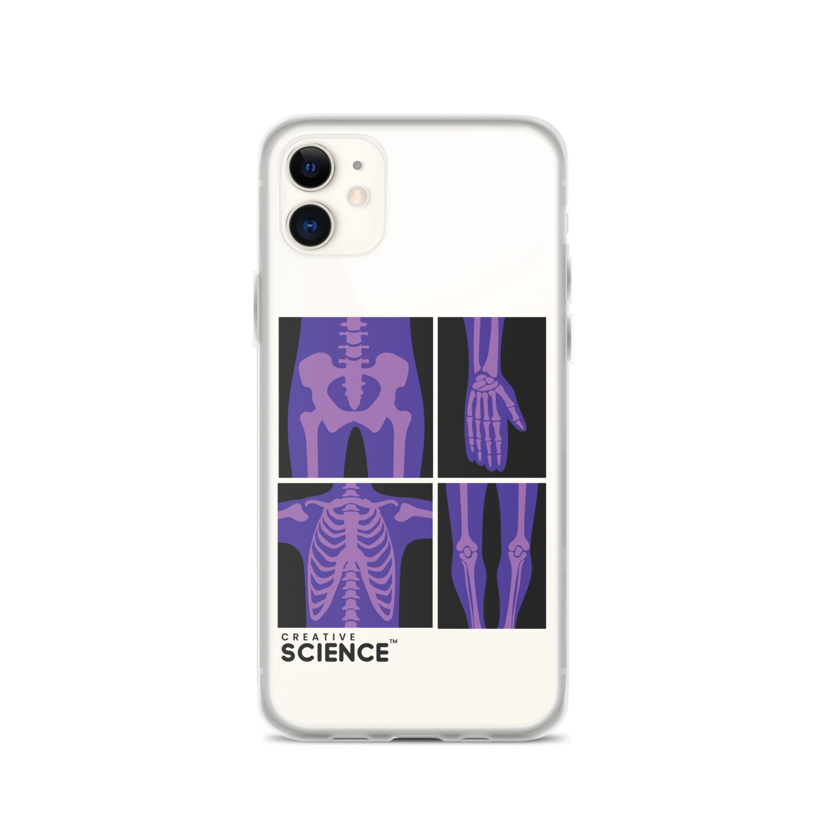 iPhone Case - Image 2