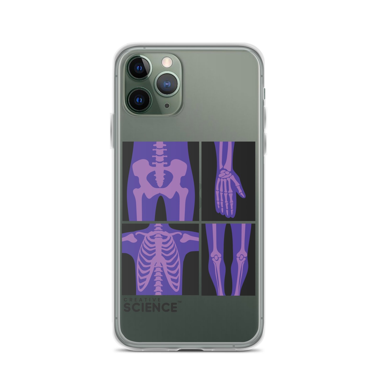 iPhone Case - Image 3