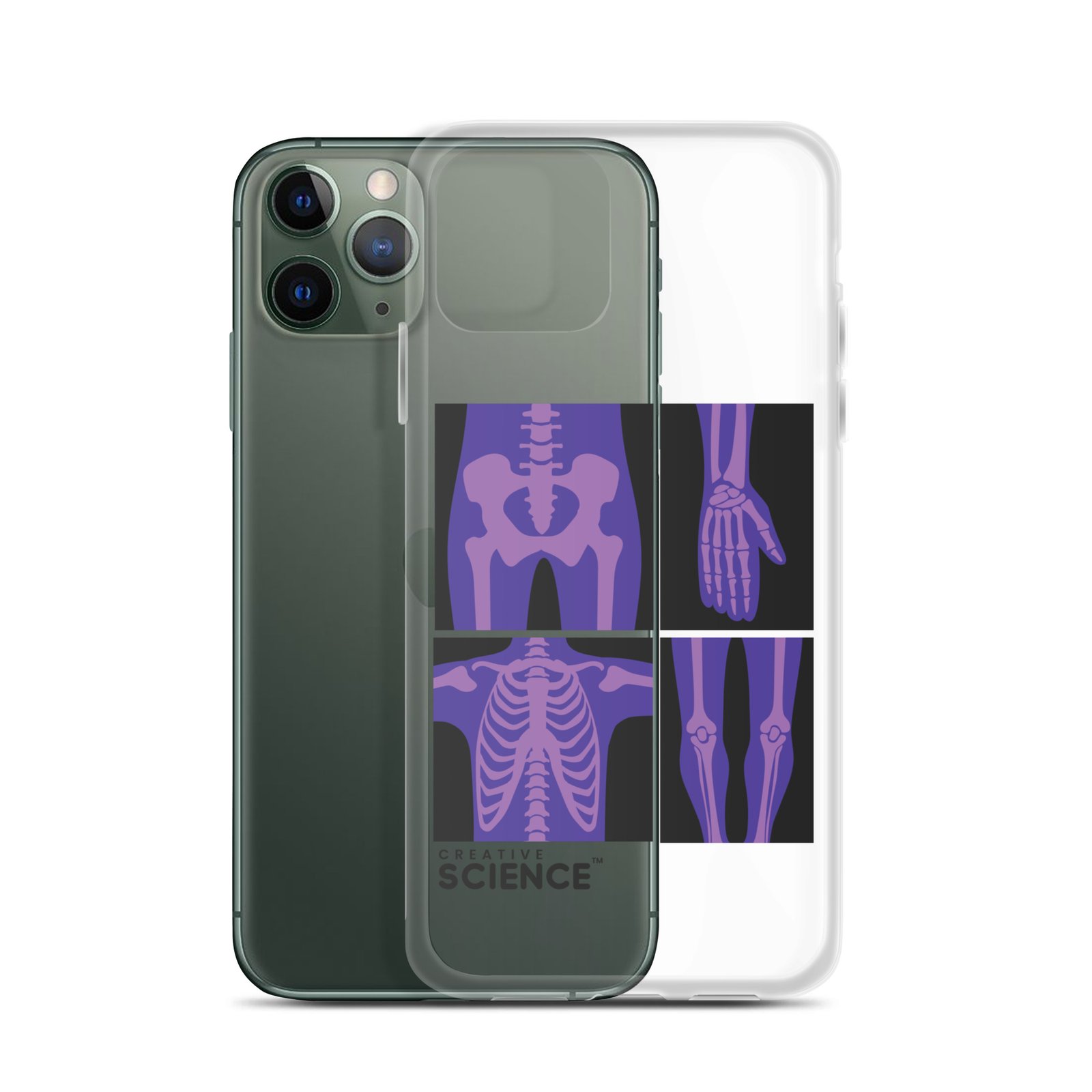 iPhone Case - Image 4