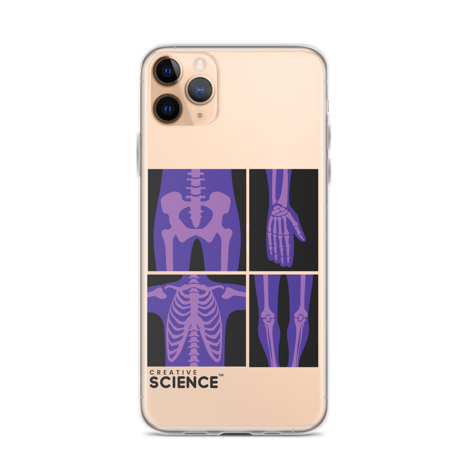 iPhone Case - Image 5