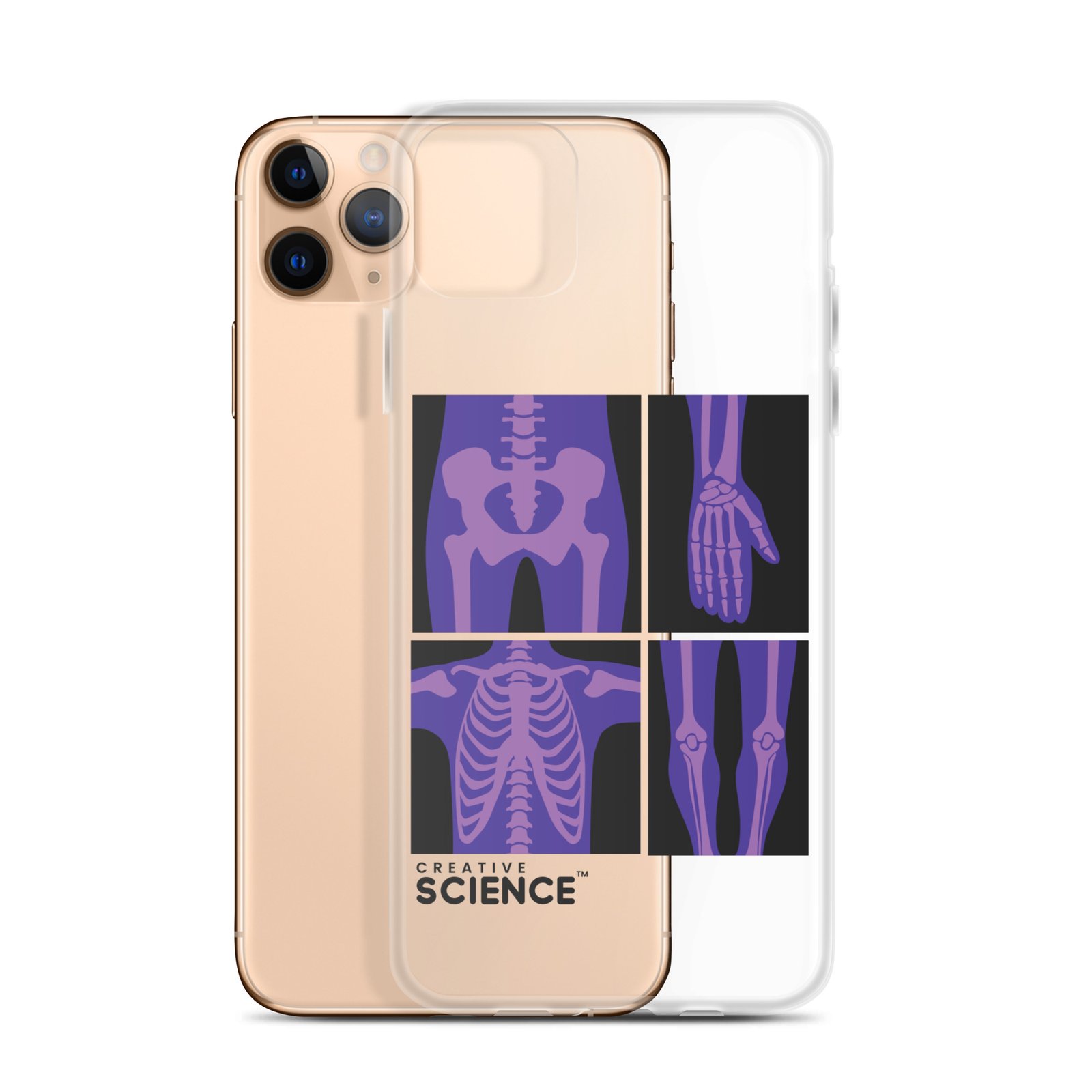 iPhone Case - Image 6