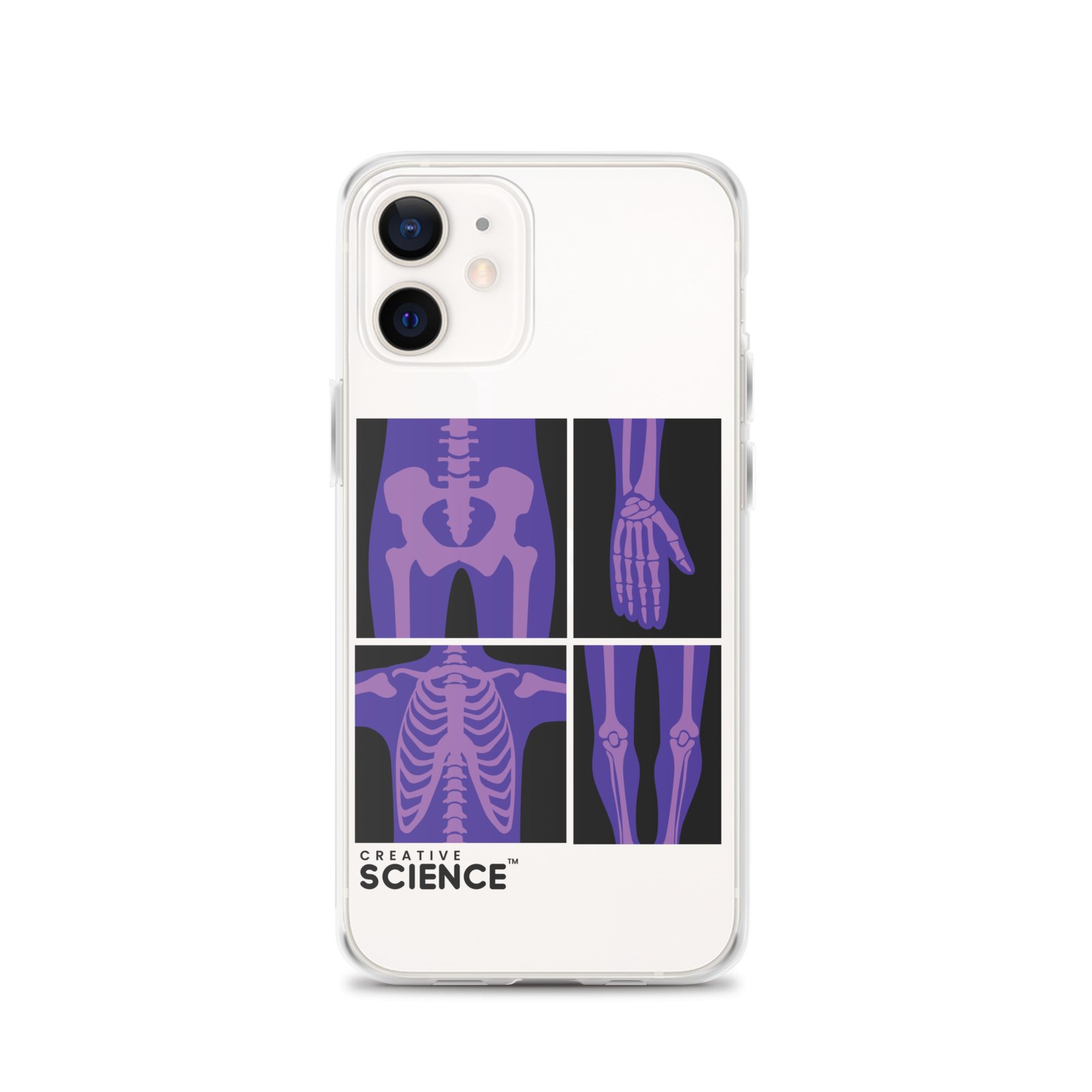 iPhone Case - Image 7