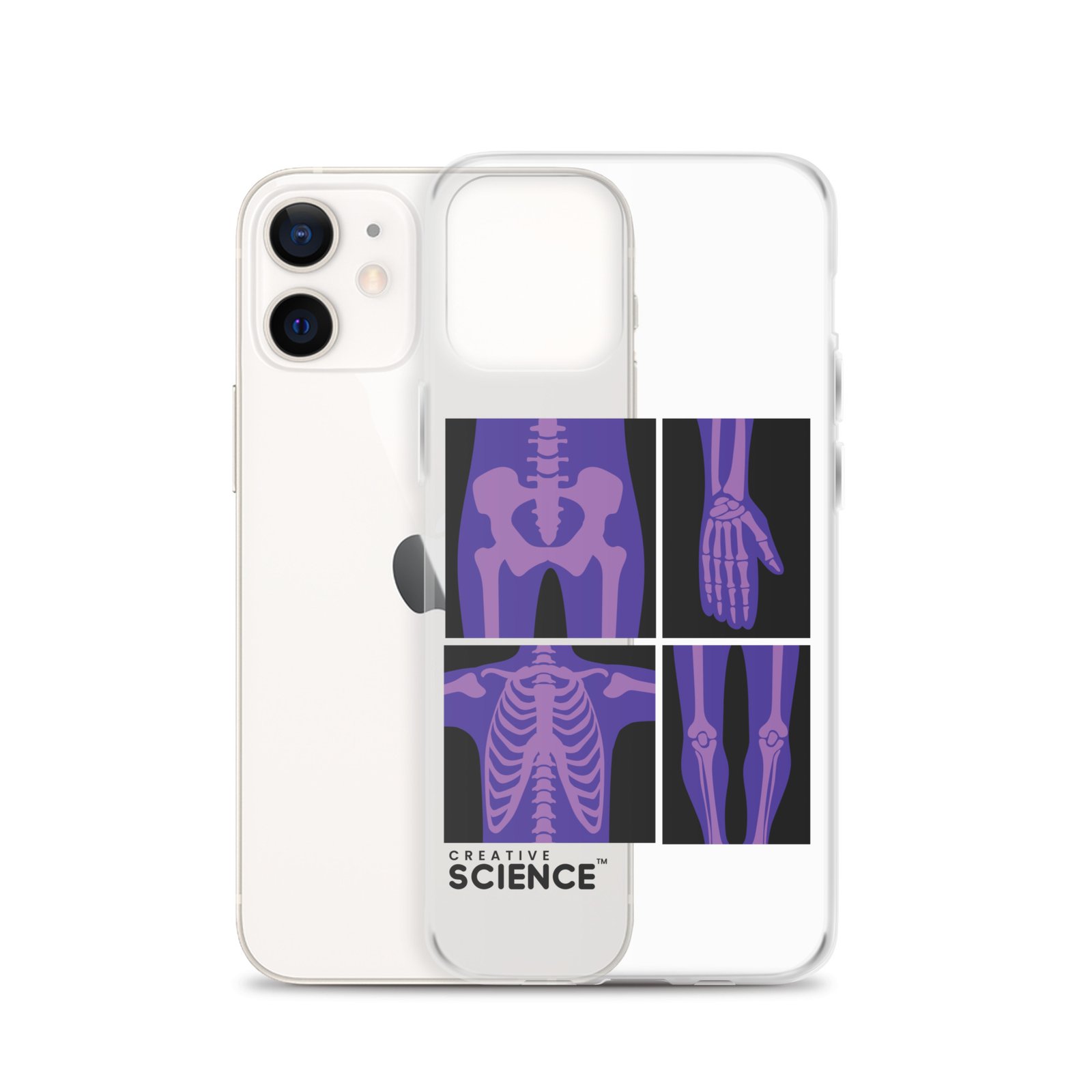 iPhone Case - Image 8