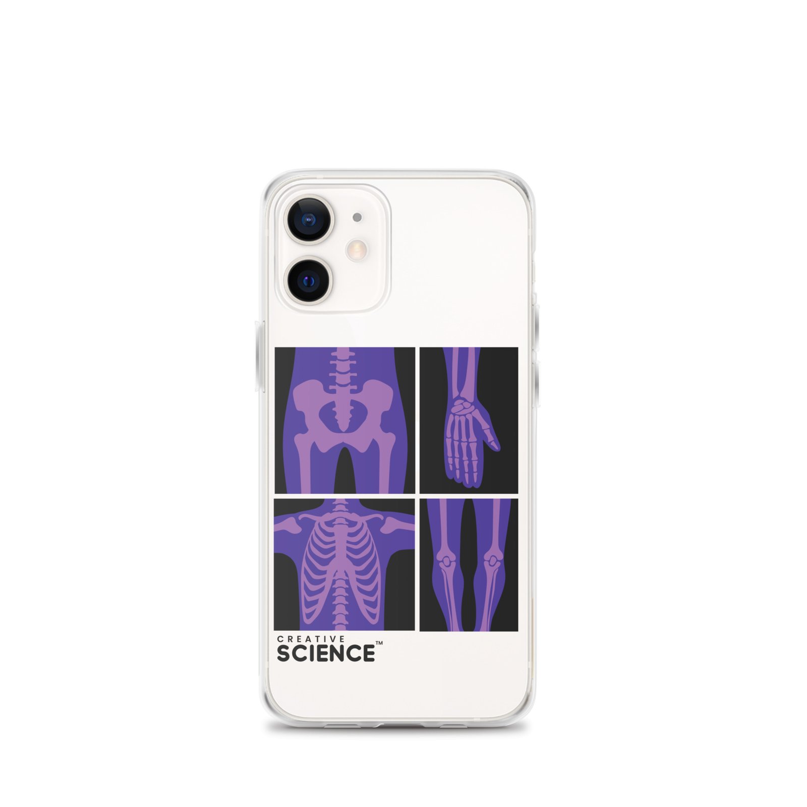 iPhone Case - Image 9