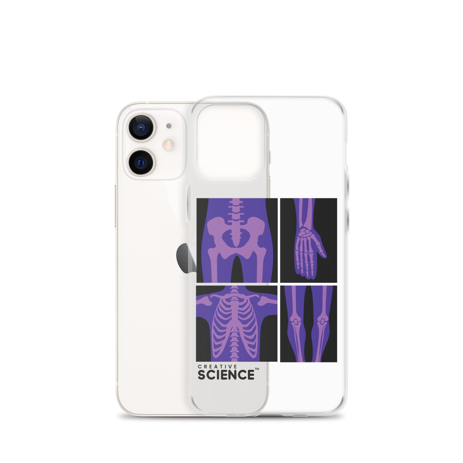iPhone Case - Image 10