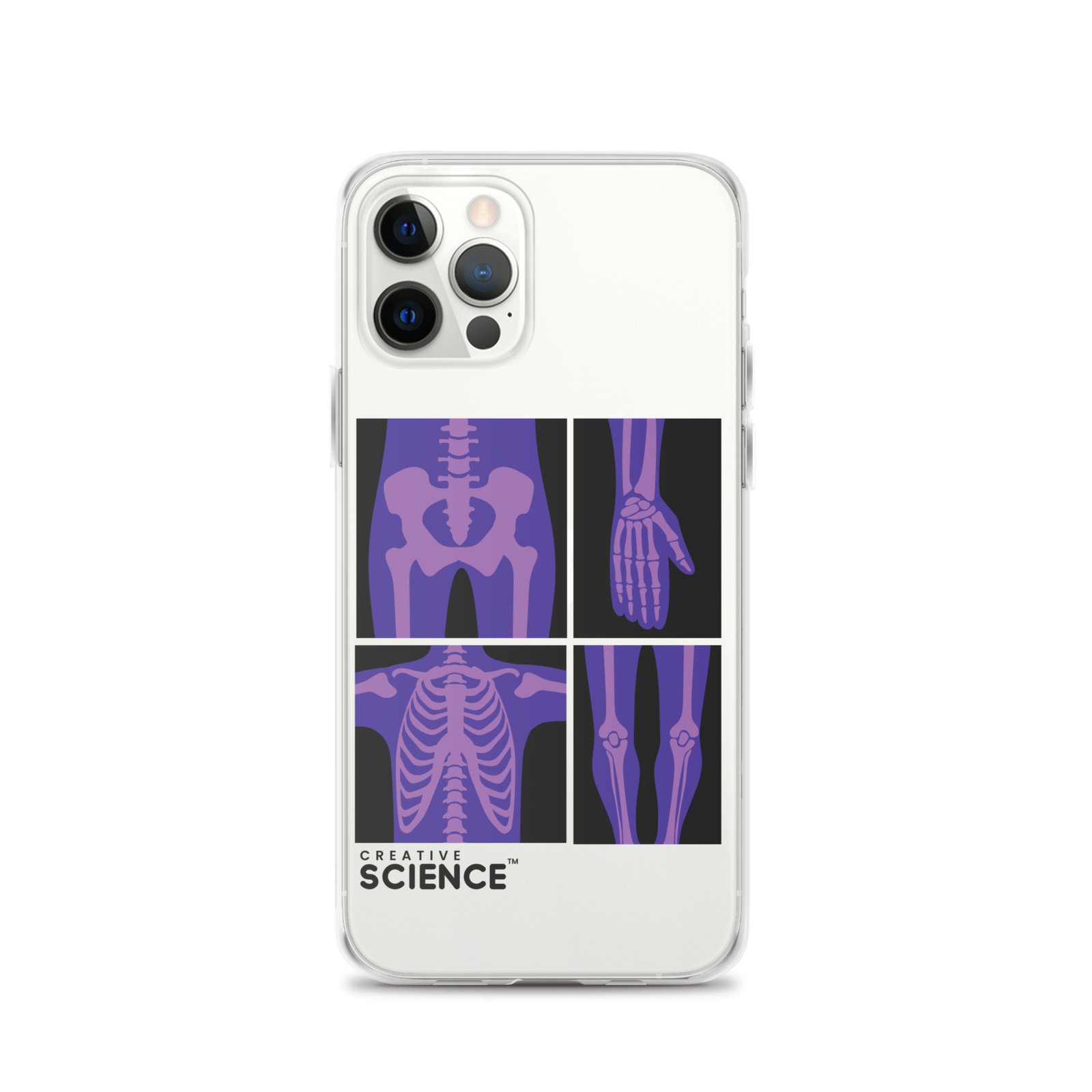 iPhone Case - Image 11