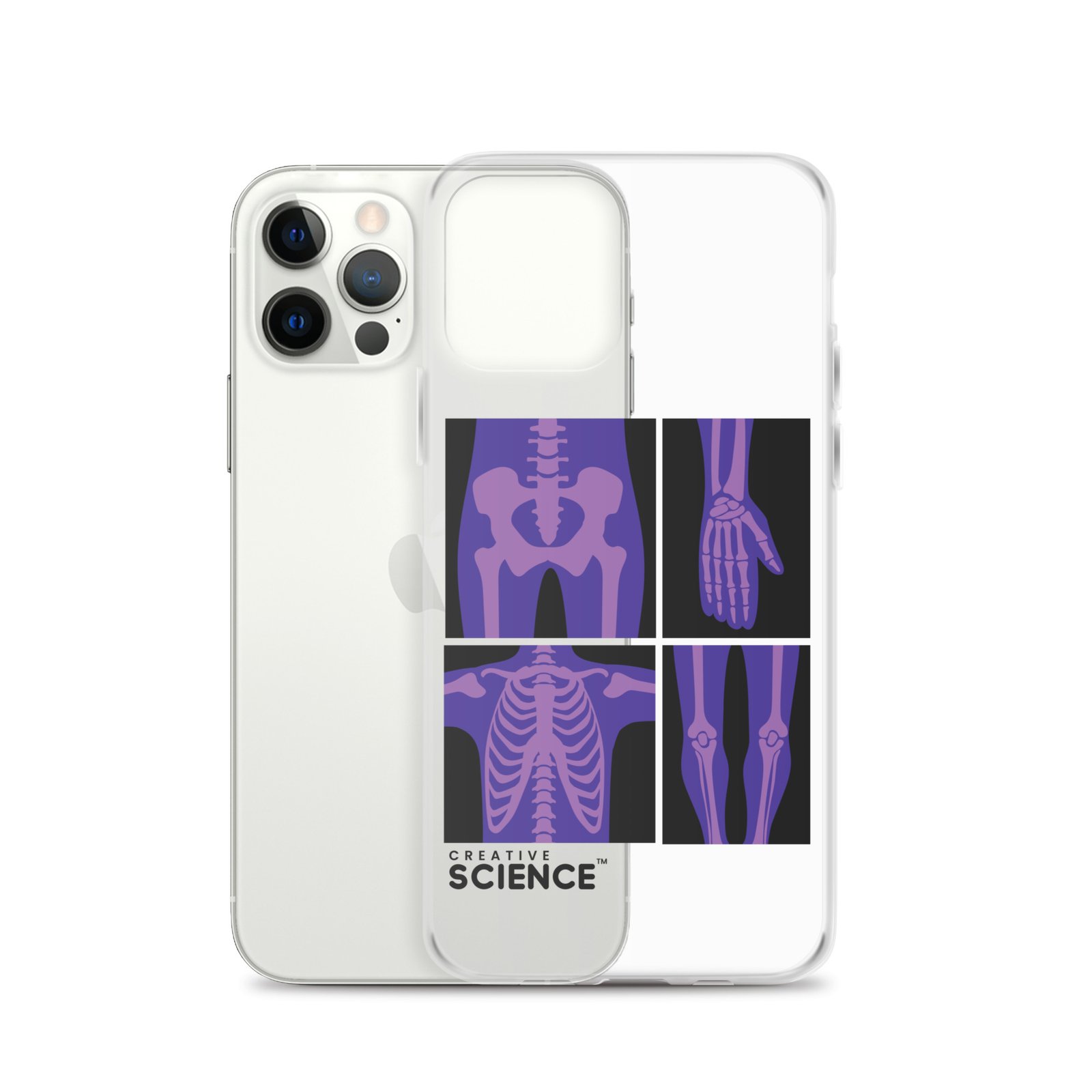 iPhone Case - Image 12