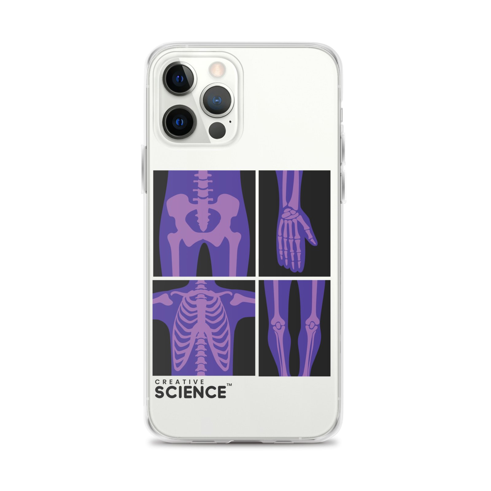 iPhone Case - Image 13