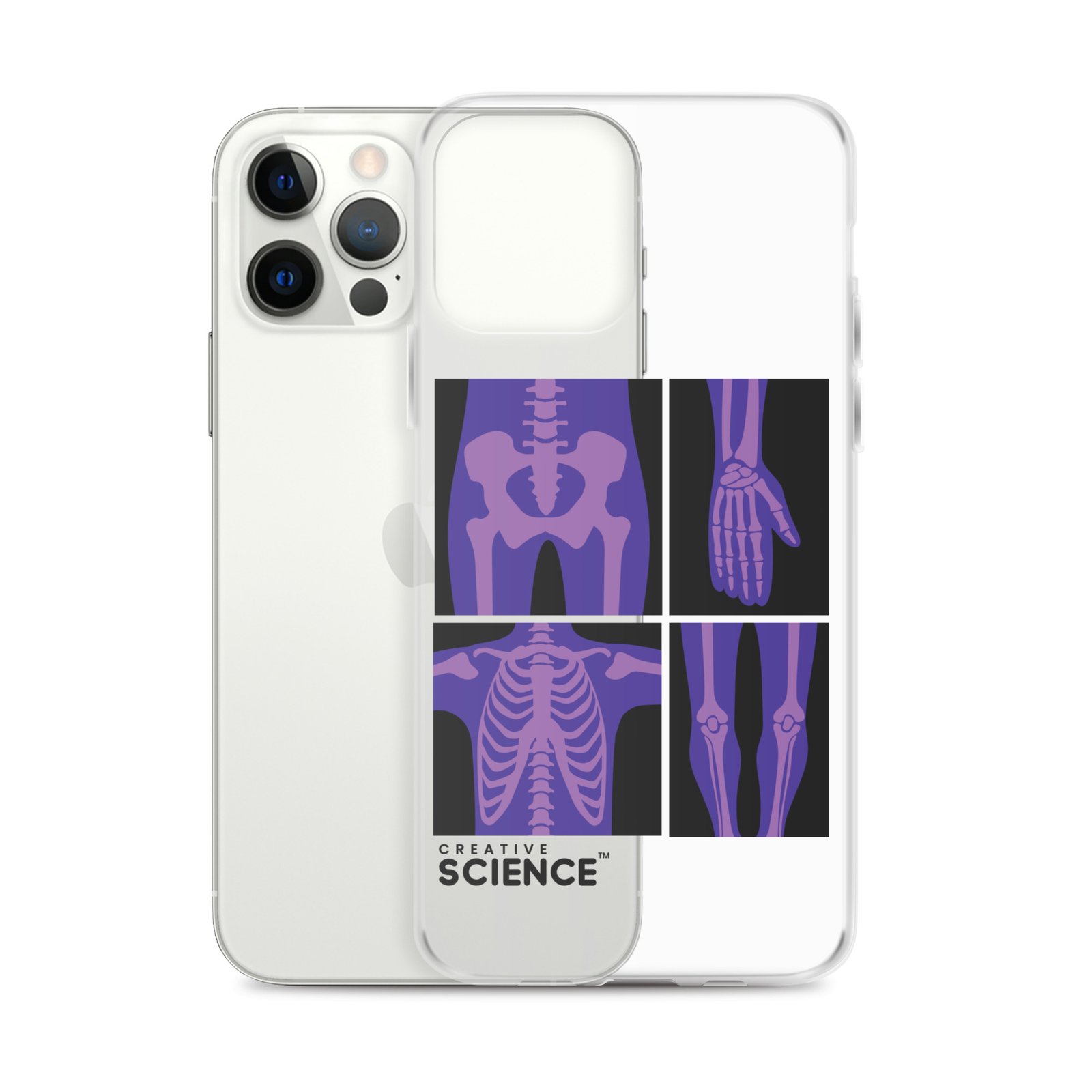 iPhone Case - Image 14