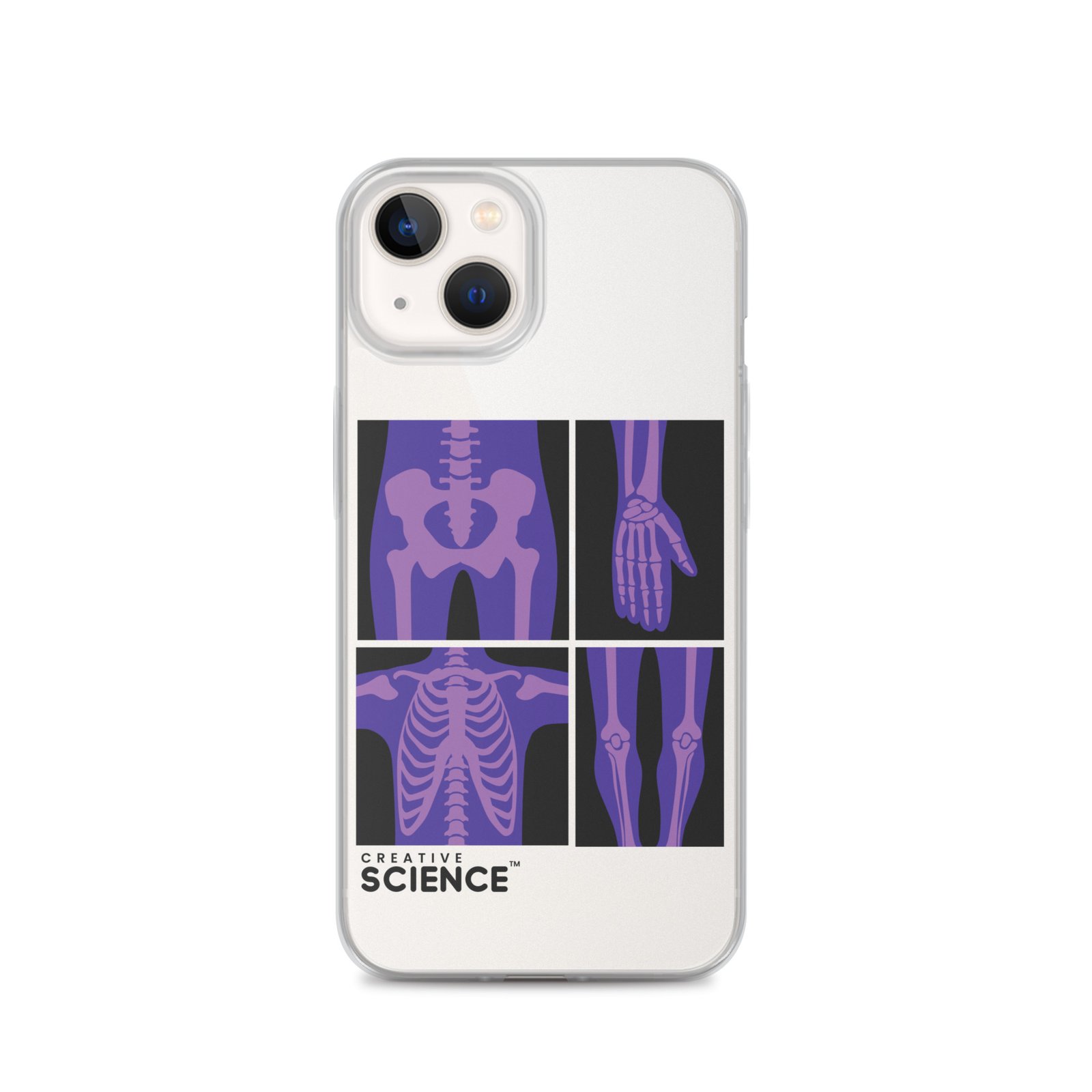 iPhone Case - Image 21