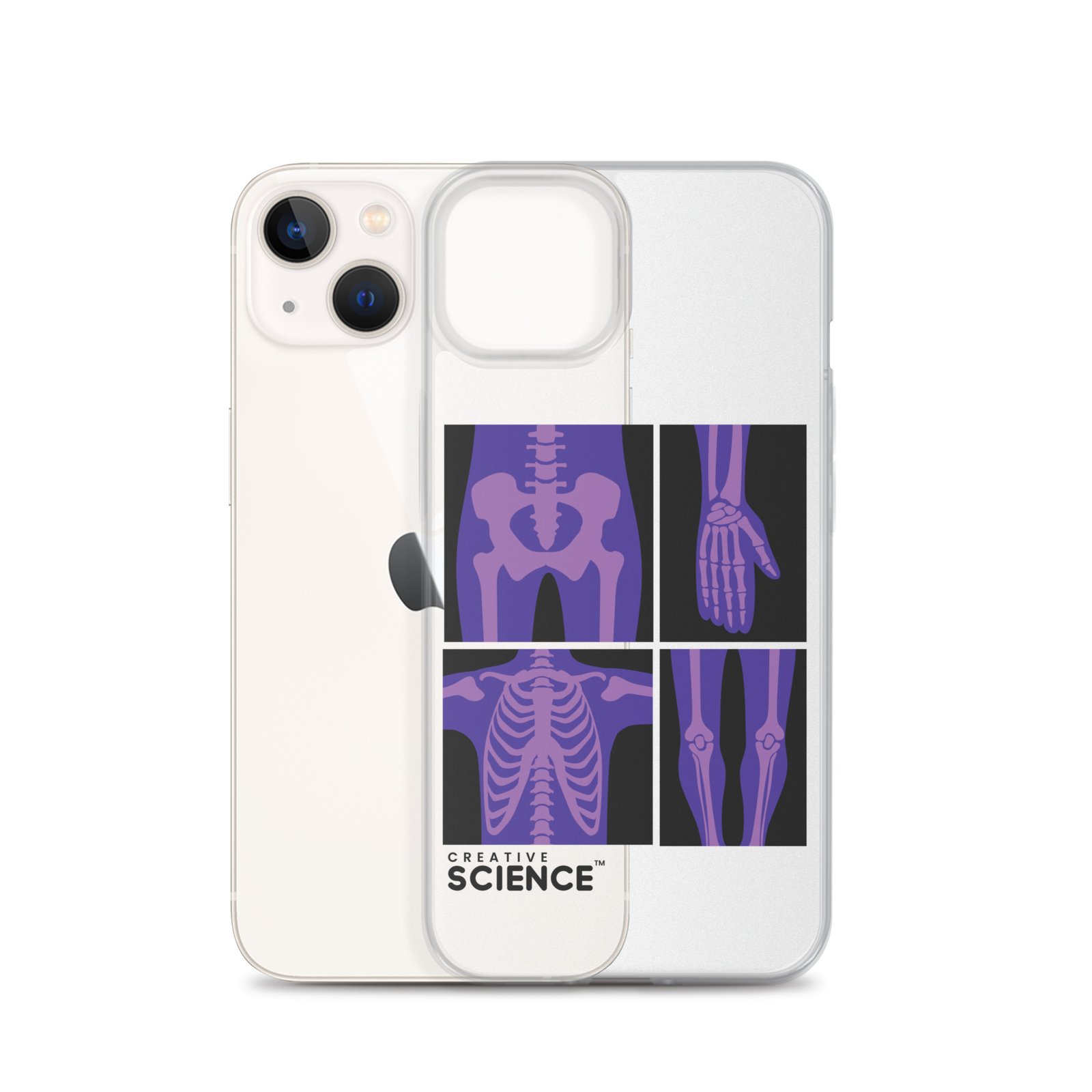 iPhone Case - Image 22