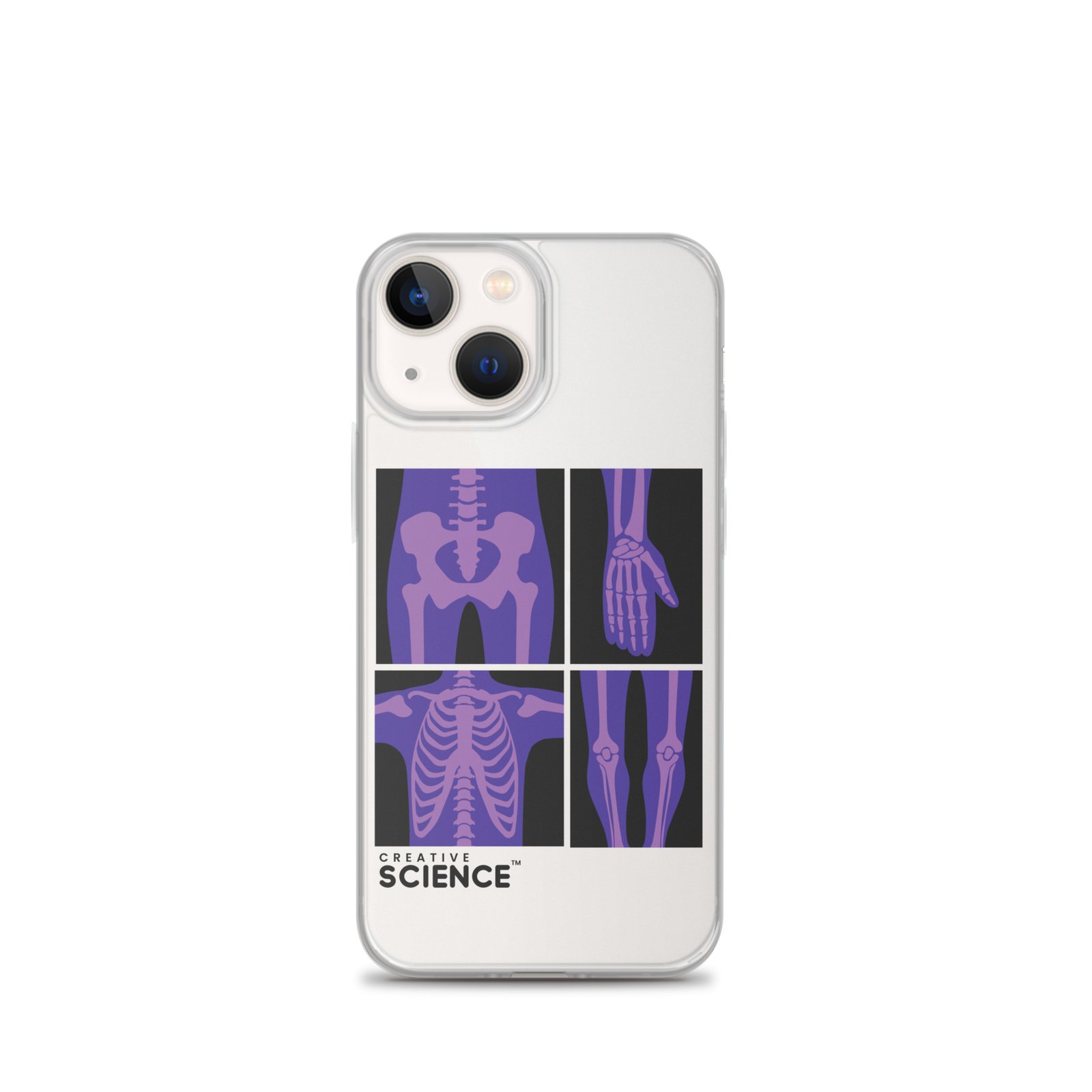 iPhone Case - Image 15