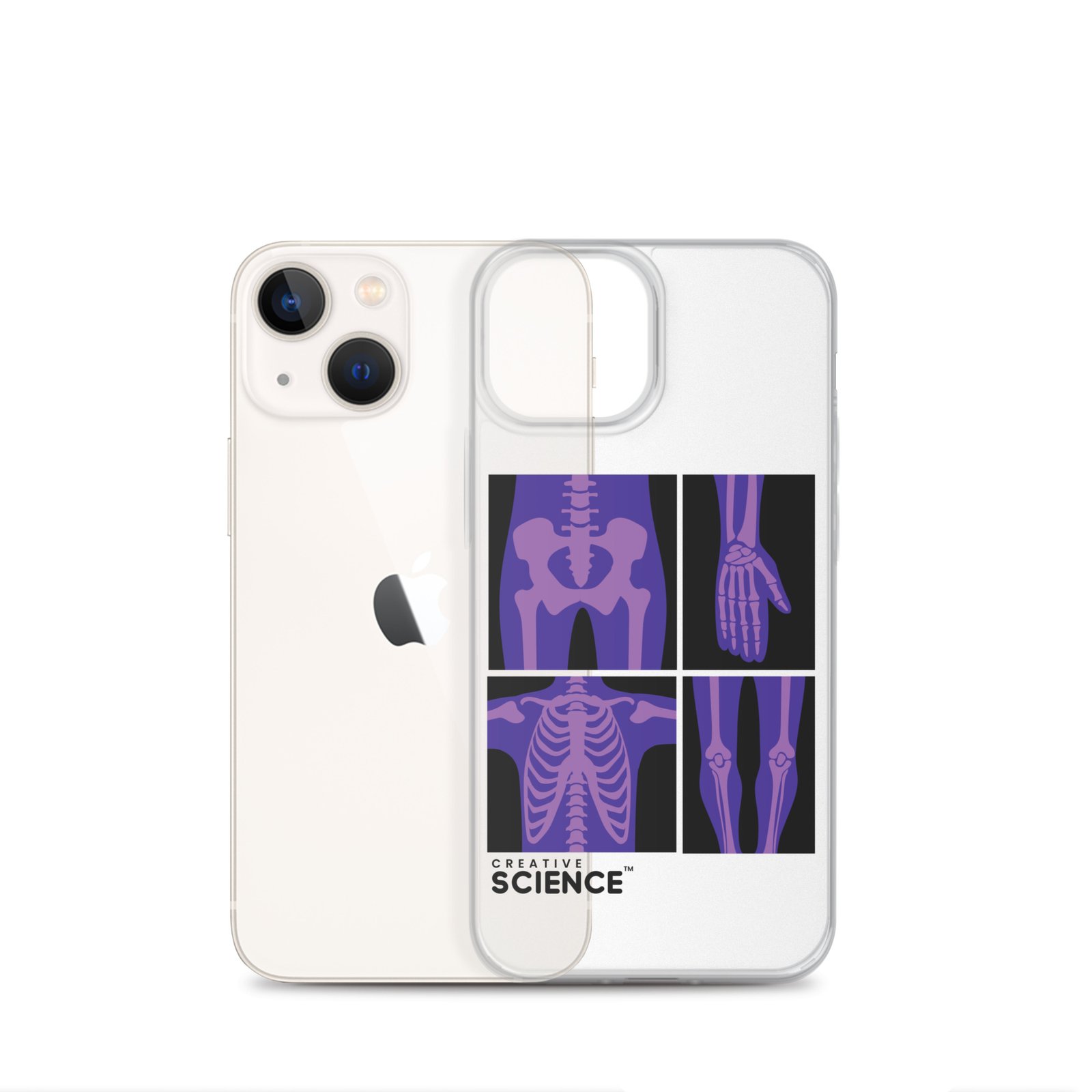 iPhone Case - Image 16