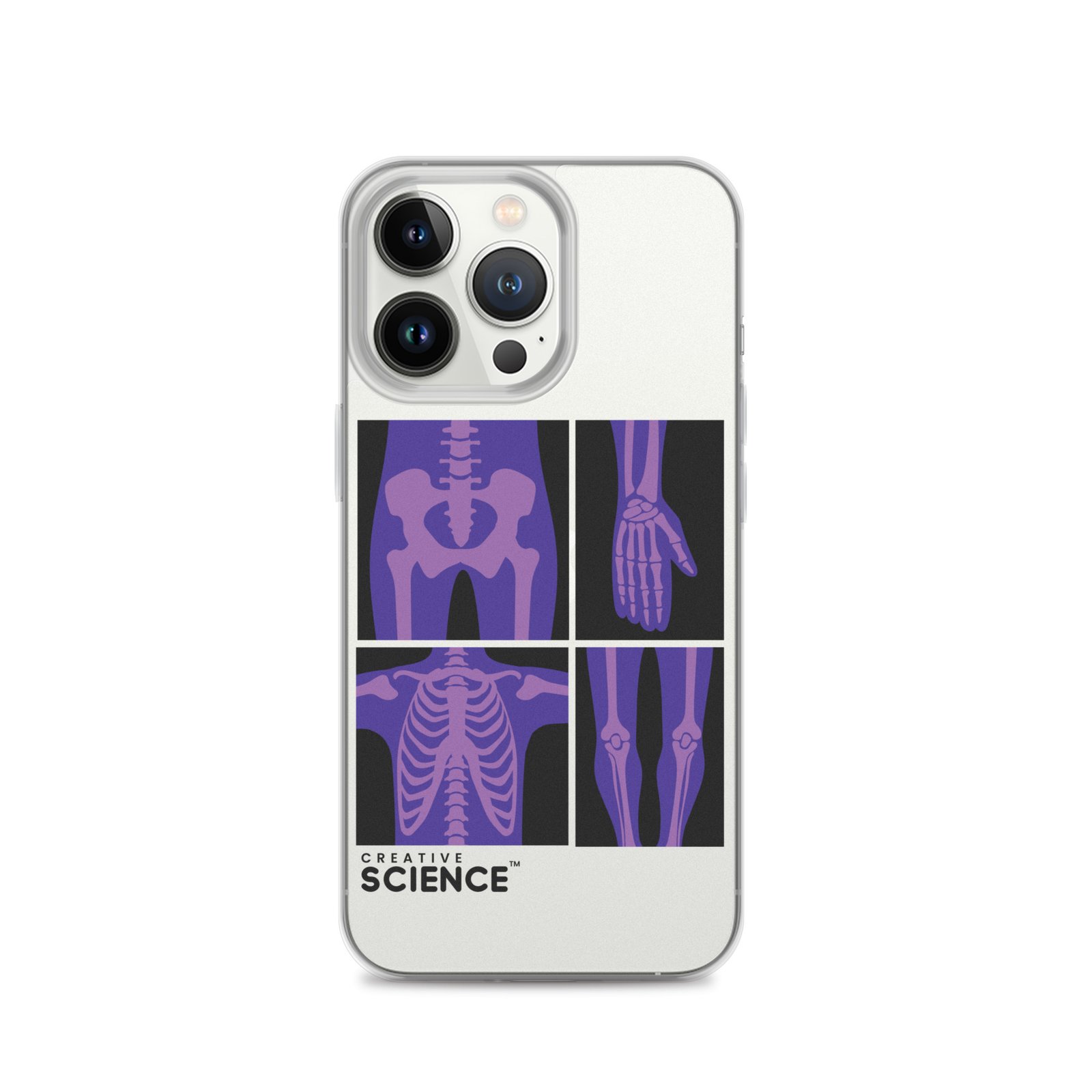 iPhone Case - Image 19