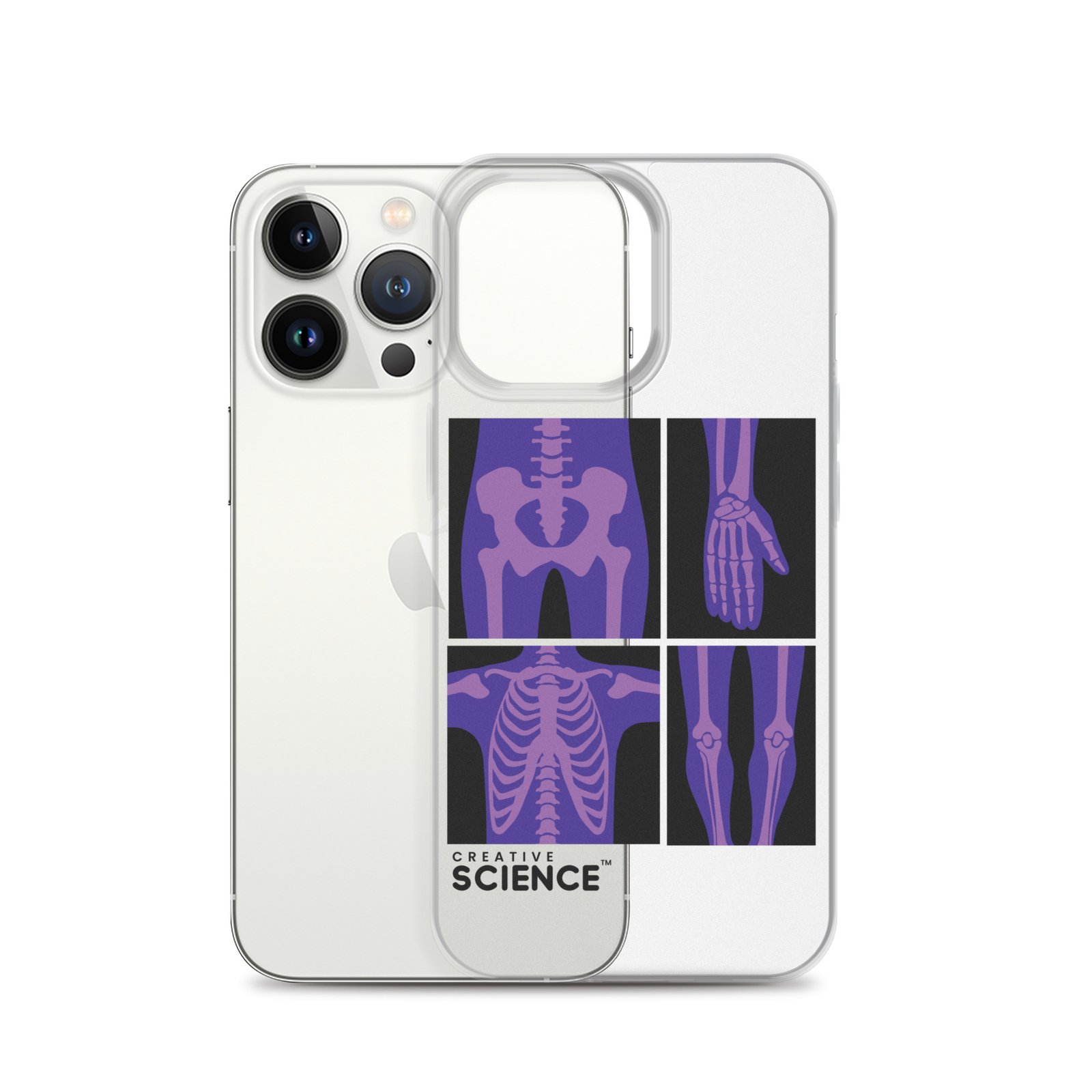 iPhone Case - Image 20