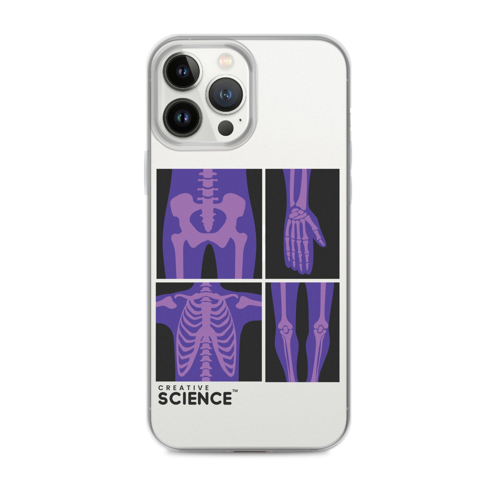 iPhone Case - Image 17