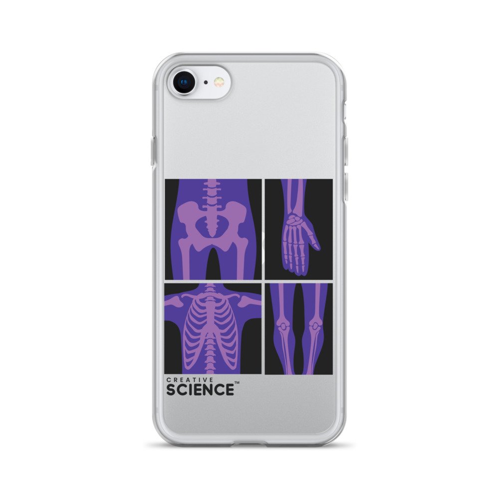 iPhone Case - Image 23