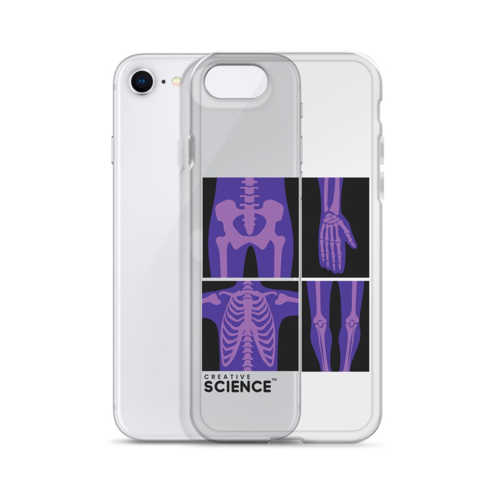 iPhone Case - Image 24